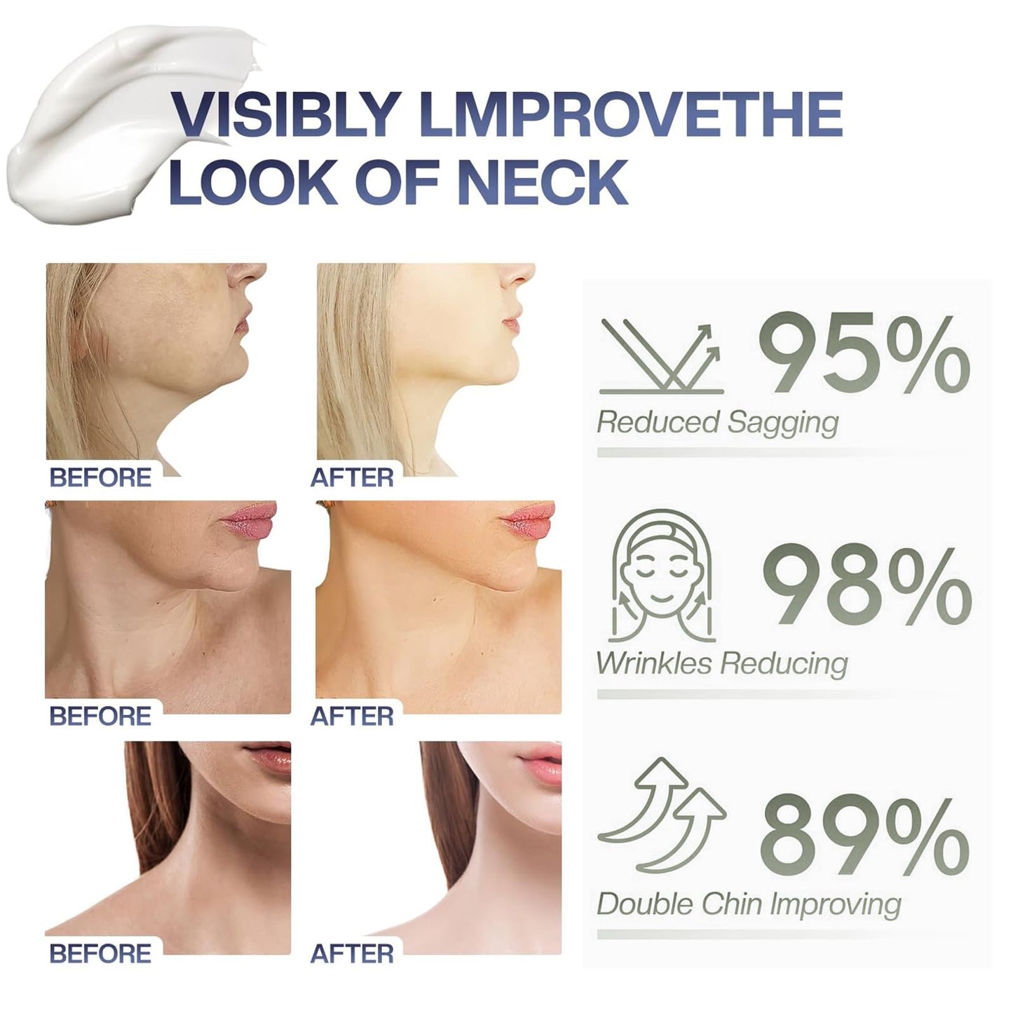 NLFOX Neck Firming Cream - Neck Cream for Crepey Skin Body Care Comfort - Collagen & Hyaluronic Acid Neck Tightening Cream - Tighten and Lift Neckcream for Women & Men on neck & Décolleté Lifting