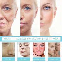 Skin Renewal Face Cream,Natural Moisturiser Face Women,Saa/m Face Cream,Dark Spot Remover for Face,Anti Aging Brightening F/ace Cre/am,Moisturiser Fa/ce Women,Rich Emollient for Dark Spots,Non-Greasy