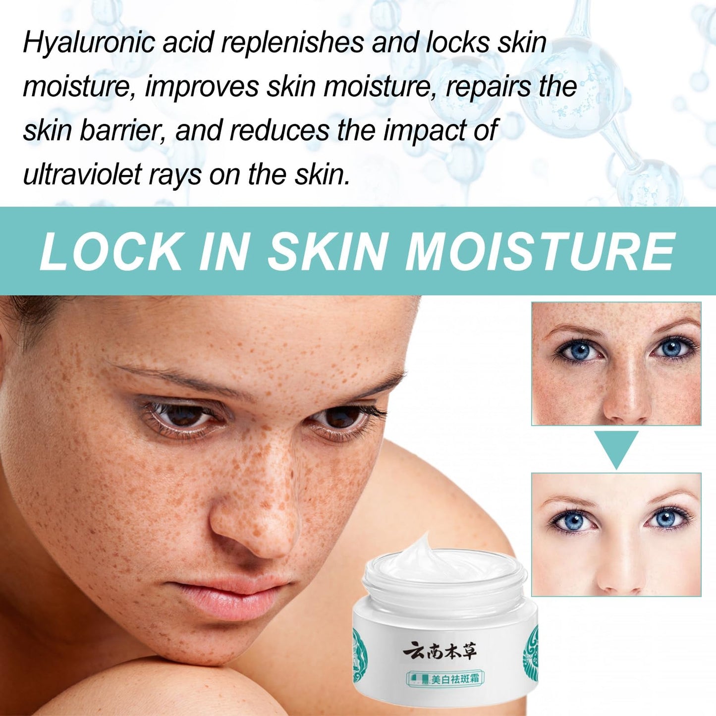 White Spot Cream,Herbal Freckle-Removing Cream,Lightening Cream for Face,Dark Spot Remover for Face,Dark Spot Corrector,Spot Cream,Freckle Removal Cream,Age Spot Remover for Face,Dark Spot Serum