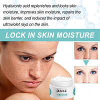 White Spot Cream,Herbal Freckle-Removing Cream,Lightening Cream for Face,Dark Spot Remover for Face,Dark Spot Corrector,Spot Cream,Freckle Removal Cream,Age Spot Remover for Face,Dark Spot Serum