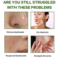 SingHao Recovery Mud Mask,Recovery Face Mask for Sensitive Skin,Recovery Mud Clay Face Mask,Mu/dMask Nourishing Re/lief,Re/lief MudM/ask for Face,Facial Mask for Deeply Cleansing,Re/lief Night Wrapping Cream