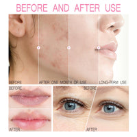 Maggikey Sakura Skincare Set For Women. Inspired By Japan, It Has Serum, Cleanser, Eye Cream, Cream, Plus Face And Lip Masks For Skin Tending