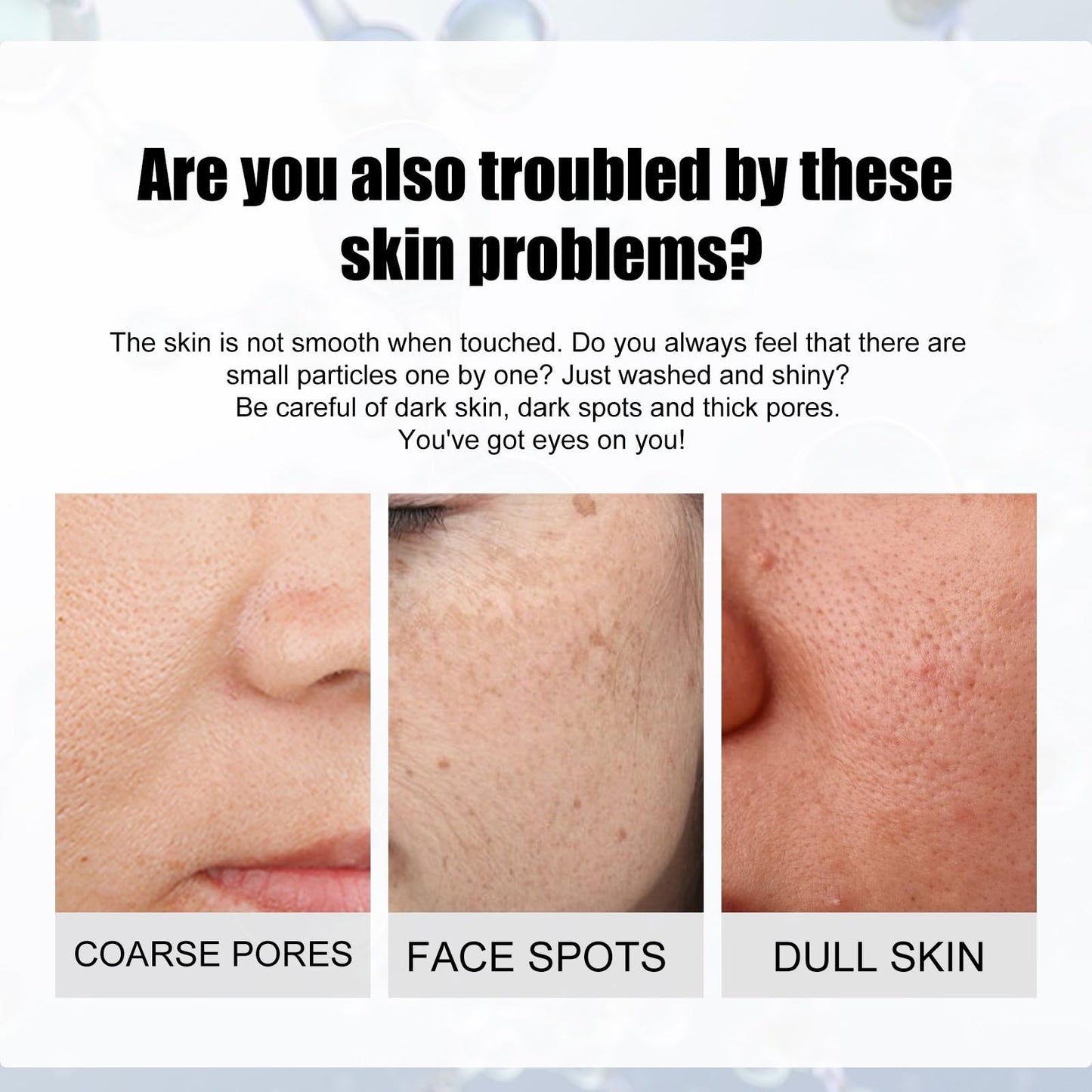 Siyinzu Dark Spot Correcting Glow Serum with 5% Niacinamide,Niacinamide Serum,Dark Spot Remover for Face,Skin Brightening Serums to Even Skin Tone,Dark Spots Correcting Serums,Face Serums Women,Facial Cream