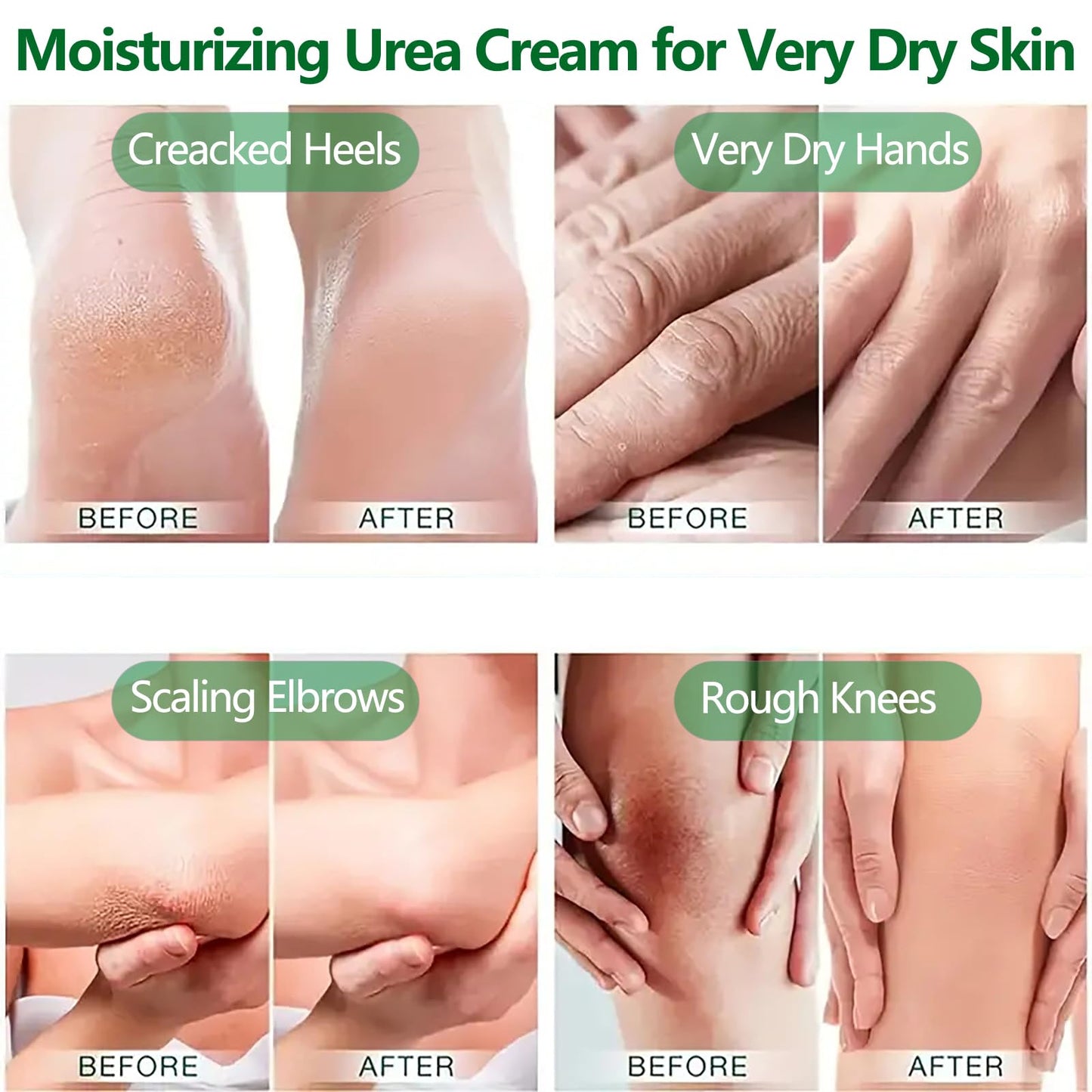 NLFOX 42% Urea Foot Cream - Heel Balm Foot Cream for Cracked Heels and Dry Skin - Urea Cream for Very Dry Feet and Hands - Foot Moisturiser Stick for Calluses and Hard Skin Repair Smooth