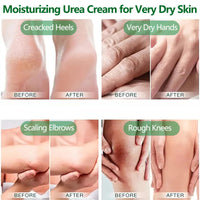 NLFOX 42% Urea Foot Cream - Heel Balm Foot Cream for Cracked Heels and Dry Skin - Urea Cream for Very Dry Feet and Hands - Foot Moisturiser Stick for Calluses and Hard Skin Repair Smooth
