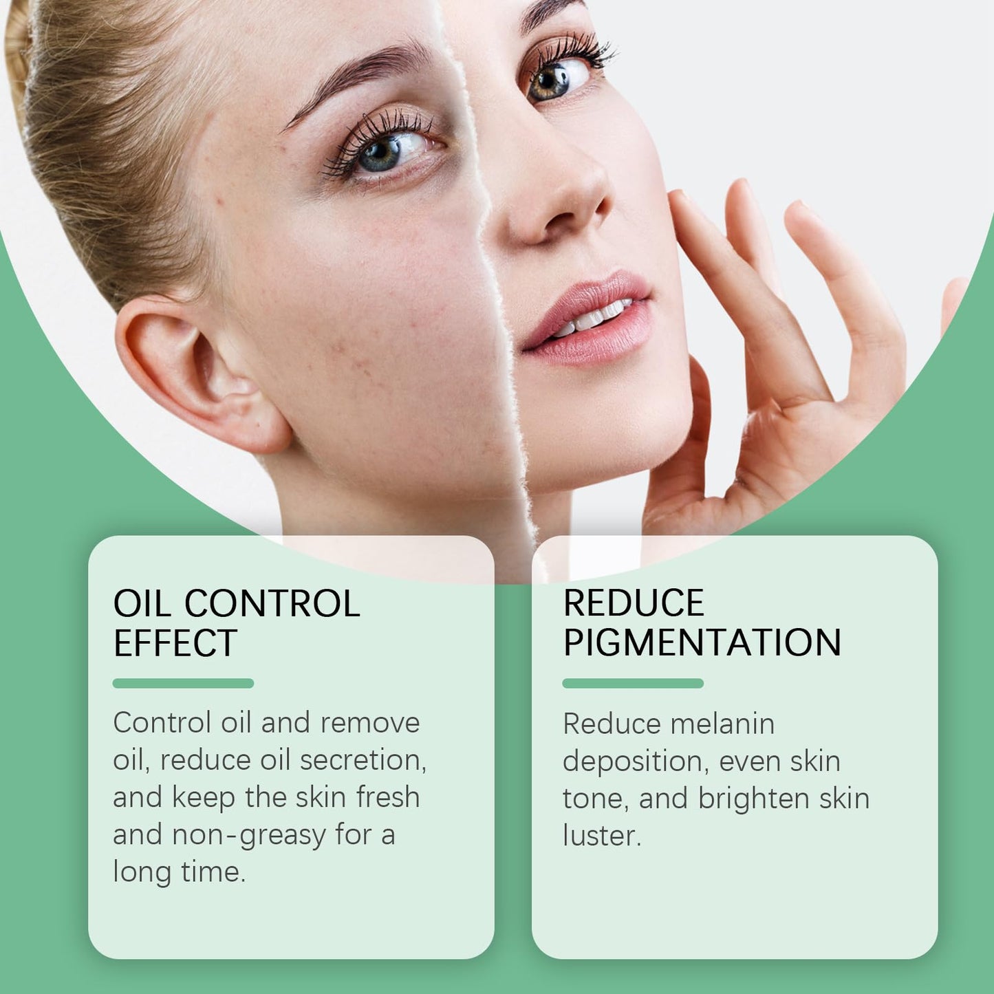 ISBEAUSOLS 2PCS Azelaic Acid Acne Cream - Spot Treatment for Acne Prone Skin - Acne Treatment - Even Skin Tone Cream for Dark Spot Remove - Hydrating Face Cream for Dry Skin - Reduces Redness, Moisturizing