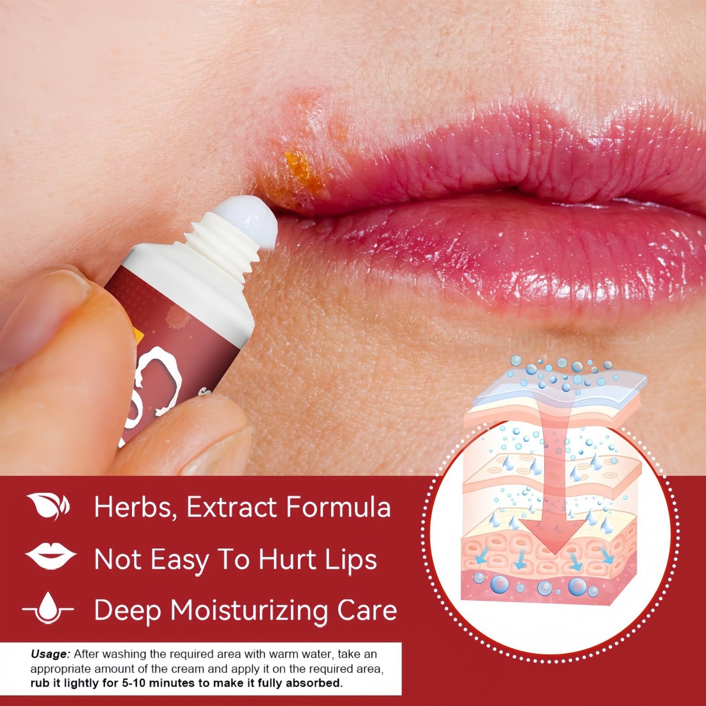 Fankayi Cold Sore Treatment Cream,Co/ld So/re Cream for Lips,Rapid Relief for Cold Sores,Mouth Ulcer Treatment for Adults,Mouth Ulcer Treatment,Mouth Th-Rush Cure for Adults,Coldsore Cream for Lips