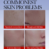 Cureluxe Dark Spot Remover For Face Cream For Women - Freckle Removal Cream – Face Moisturizer For Dark Spots – Hydrating & Skin Tone Enhancing Cream – Fade Freckles & Improve Dull Skin
