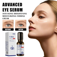 OuXing Lutein Eye Essence Oil,Vc Eye Wrinkle Essence Oil,Eye Serum,Lute-in Eye Wrinkle Es-sence Oi-l,Lutein Anti-Wri-nkle Eye Serum O-il,E-ye Roller for Dark Circles and Puffiness,Fading Anti-Wrink-le