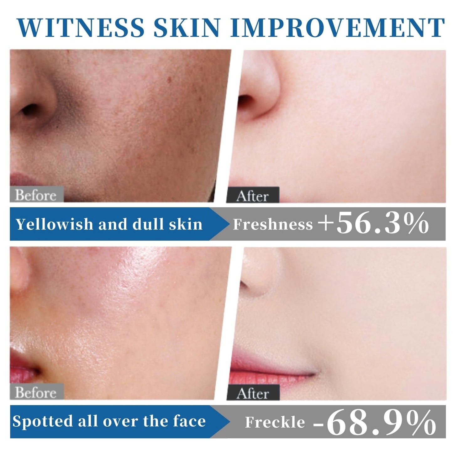 345 Barrier Repair Face Cream - 345 Relief Cream - Face Moisturizer for Soothing - Releif Moisturiser for Acne & Repair Damage Skin - Face Cream for Dry Skin ( 2pcs)