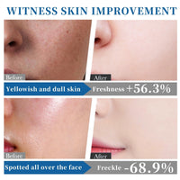 345 Barrier Repair Face Cream - 345 Relief Cream - Face Moisturizer for Soothing - Releif Moisturiser for Acne & Repair Damage Skin - Face Cream for Dry Skin ( 2pcs)