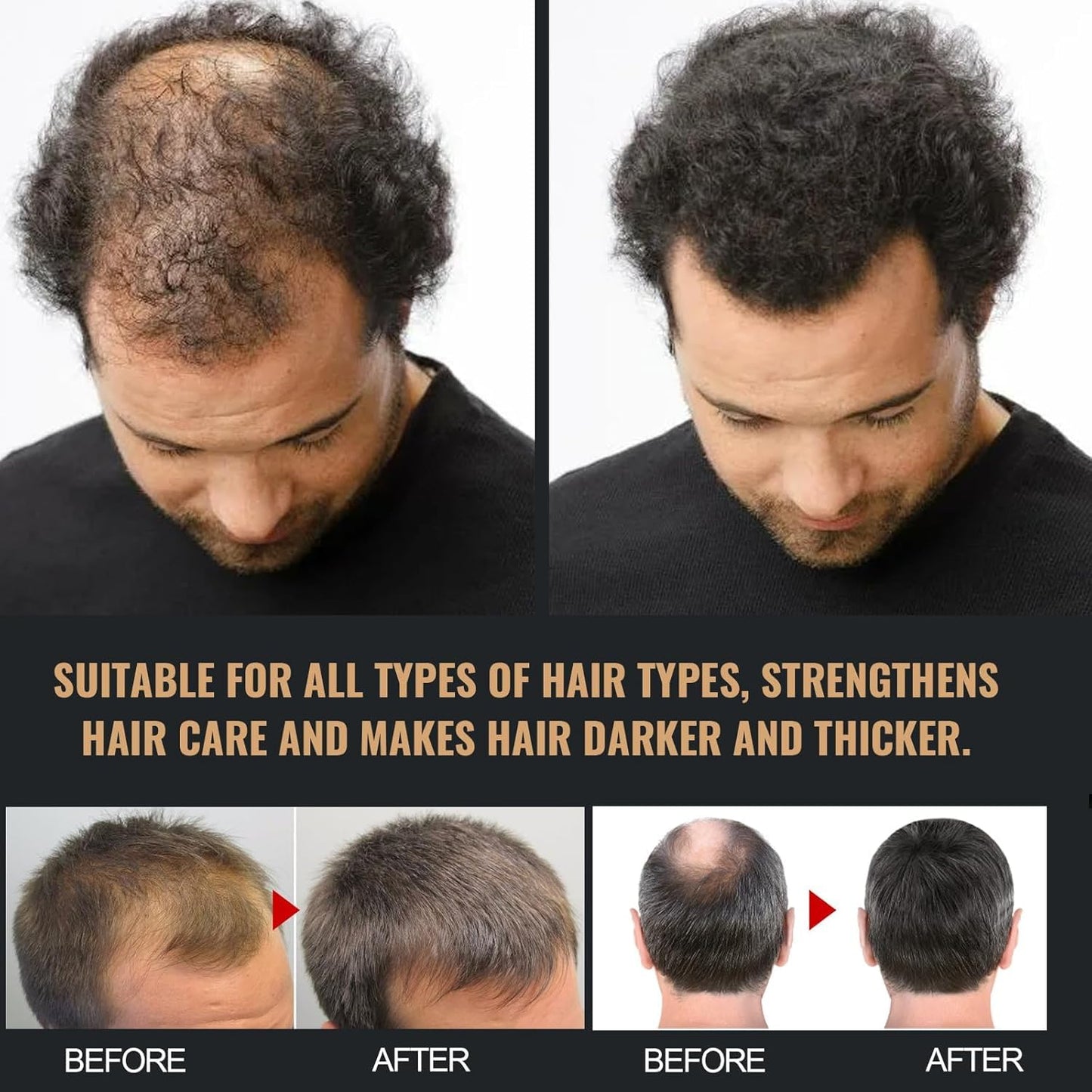 Generic Root Activator Shampoo,Mane Root Activator Shampoo for Man,Unisex Hair Loss