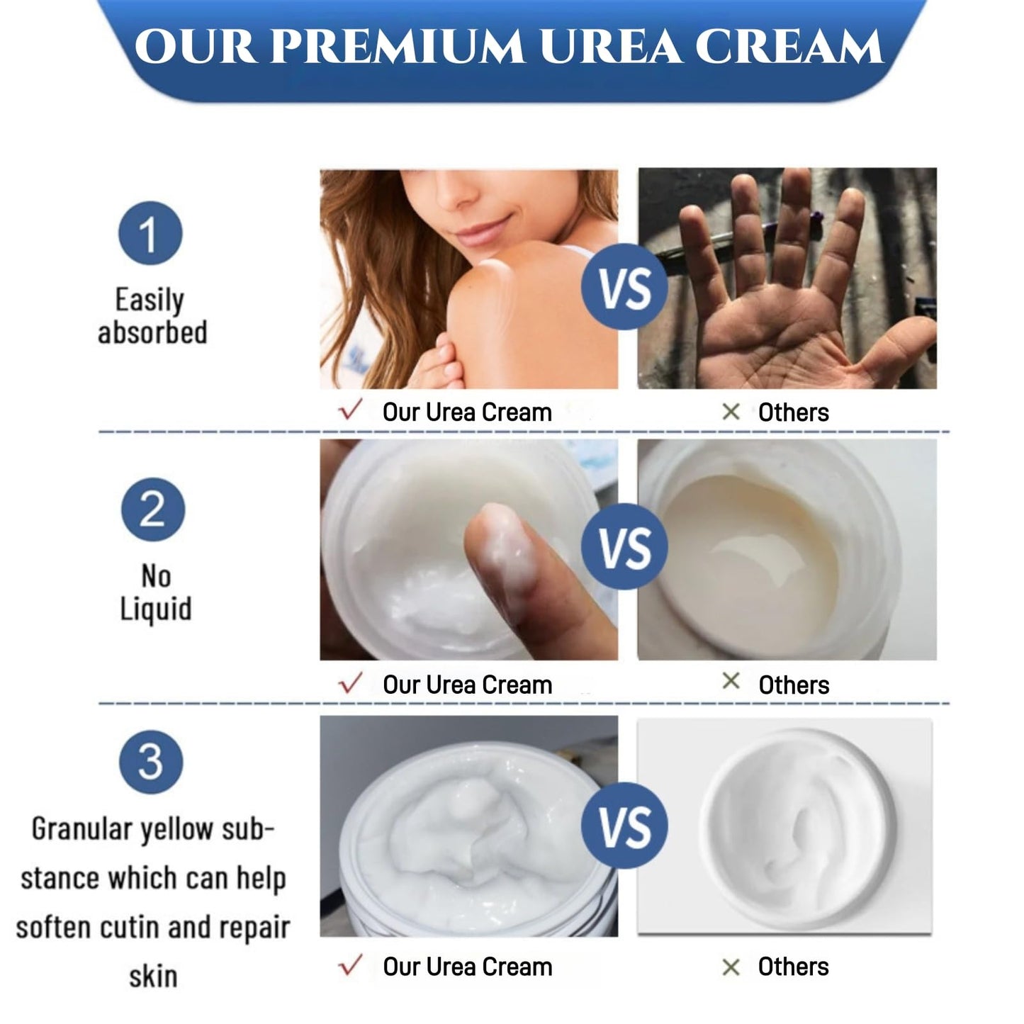 40% Urea Cream - Hand & Foot Creams, Urea Foot Cream Fast-Acting Cracked Heel Repair, Hydrating Lotion for Cracked Heels and Dry Skin Deep Moisturizing, Softens Calluses, Nourishes Rough Skin