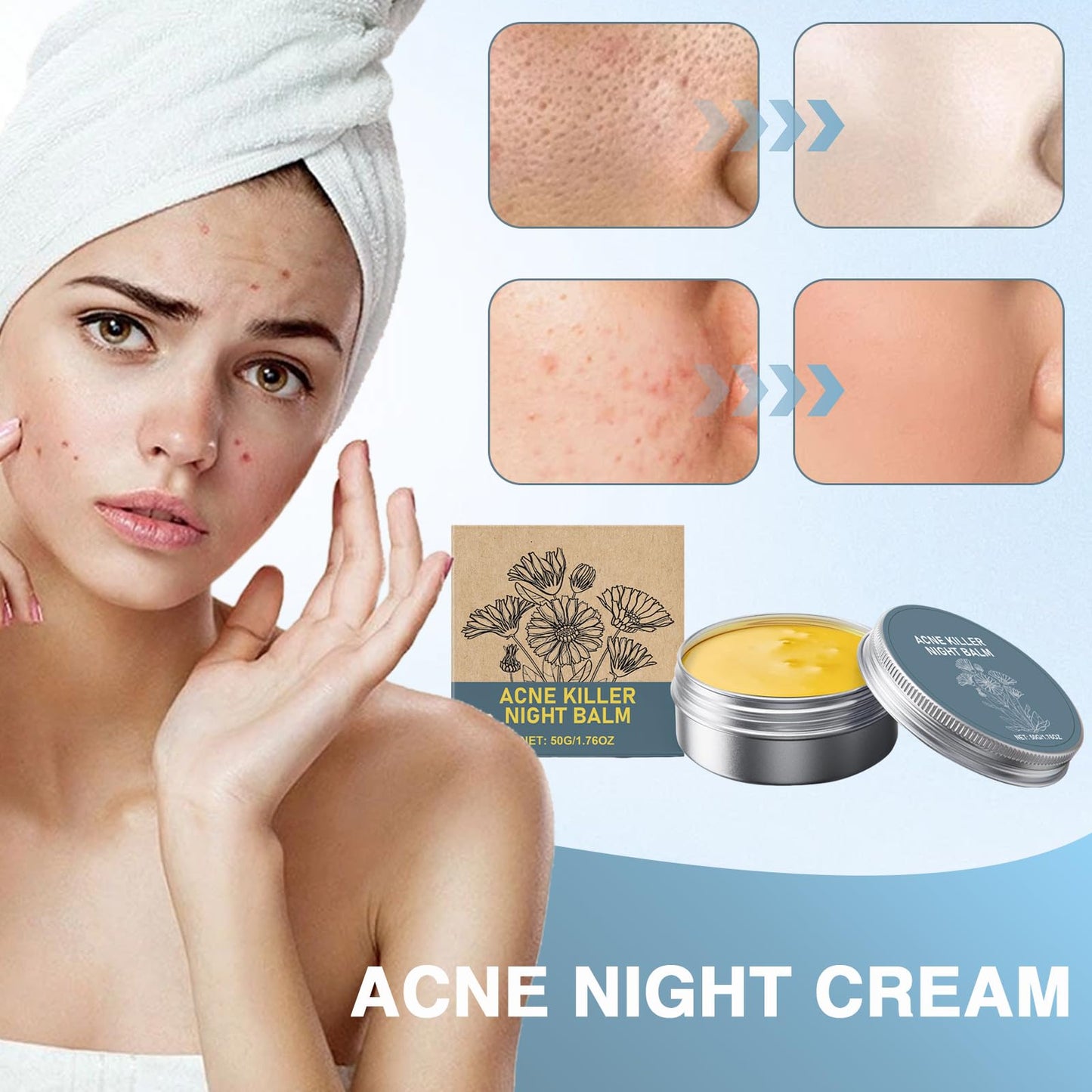 DOOCECIY 2 PCS Pimple Cream, Nourishing Acne Balm for All Skin Types
