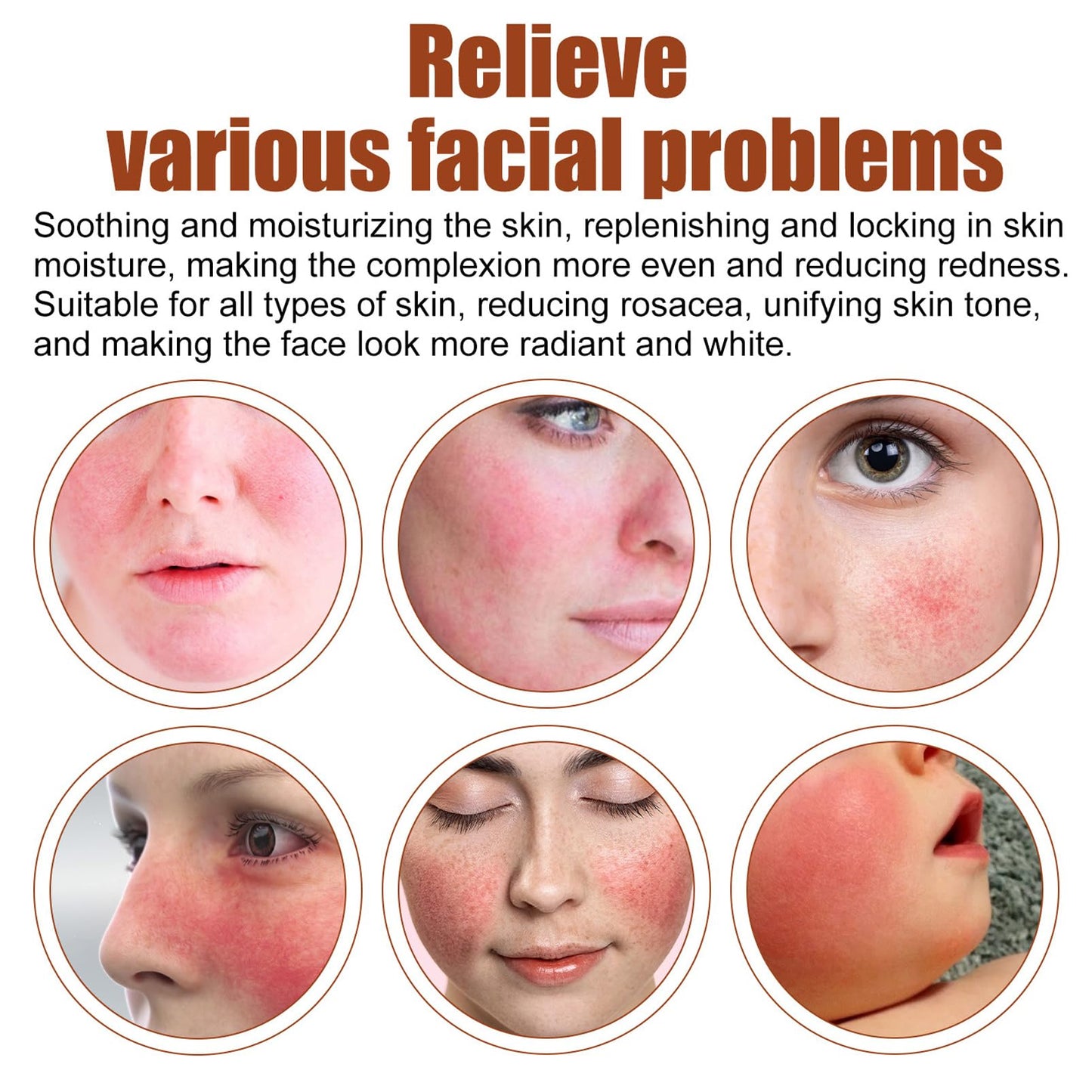 DMQ Rosacea Face Serum,Face Serum Hyaluronic Acid,Face Oil Anti-Aging,Relieve Redness &Quick Repair Damage Skin,Niacinamide Serum,Replumps & Hydrates,Collagen Face Serum-Protect Skin+Reduce Acne-Women