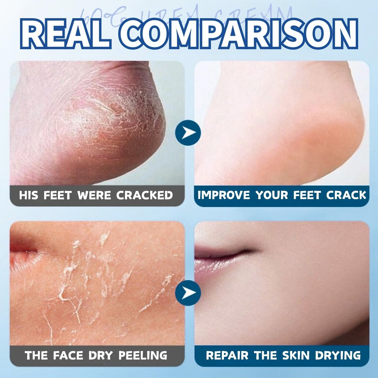 60% Urea Cream - Urea Cream 60 Percent for Feet - Cracked Heel Repair Cream - Ure_a Foot Cream Stick Plus 2% Salicylic Acid For Calluses - Foot Crea_m For Cracked Heels And Dry Skin 1pc