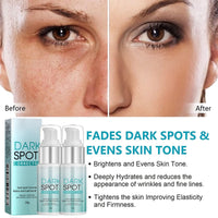 2PCS Dark Spot Remover, Dark Spot Remover For Face, Dark Spot Corrector, Age Spot Remover For Face, Pigmentation Removal Cream Prevent Forming Dark Spots, Fade Spots, Improve Skin Tone (30G*2)
