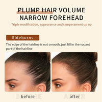 L0famy Root Cover Up Medium Brown, Root Cover Up Hairline Powder for Thin Hair, Hairline Powder, Root Touch Up Hair Powder, Water & Sweat Resistant Hair Loss Concealer Set for Thinning Hair Women (8g)