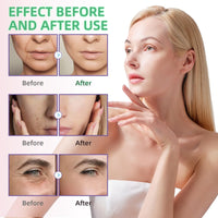 SingHao 50ml Dark Spot Correcting Glow Serum with 5% Niacinamide,Nicotinamide Facial S/erum,Hydrating & Brightening Ser/um,Niacinamide Dark S/pot Remover for Face,Dark Spot Se/rum with Hyaluronic Acid