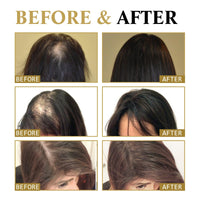 SingHao Hair Growth Roll-On Massage Essence,H/air G/rowth Serum,Roller Ball Ha/ir Care Oil,Scalp Roller,Ha/ir Treatment for Hai/r Lo/ss,Hai/r Growth Anti-Hair Lo/ss,H/air Loss Oil,Hair O/il Growth