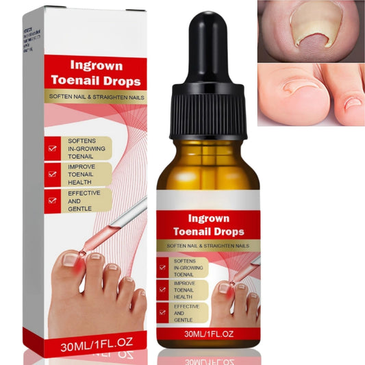 Ingrown Toenail Treatment Drop,Nail Growth Ingrowing Toenail Treatment,Cuticle Care Oils for Ingrown Toenails,Nail Growth Treatment,Ingrowing Toe Nail Treatment,Toe Nail Fungus Treatment Cuticle Oil