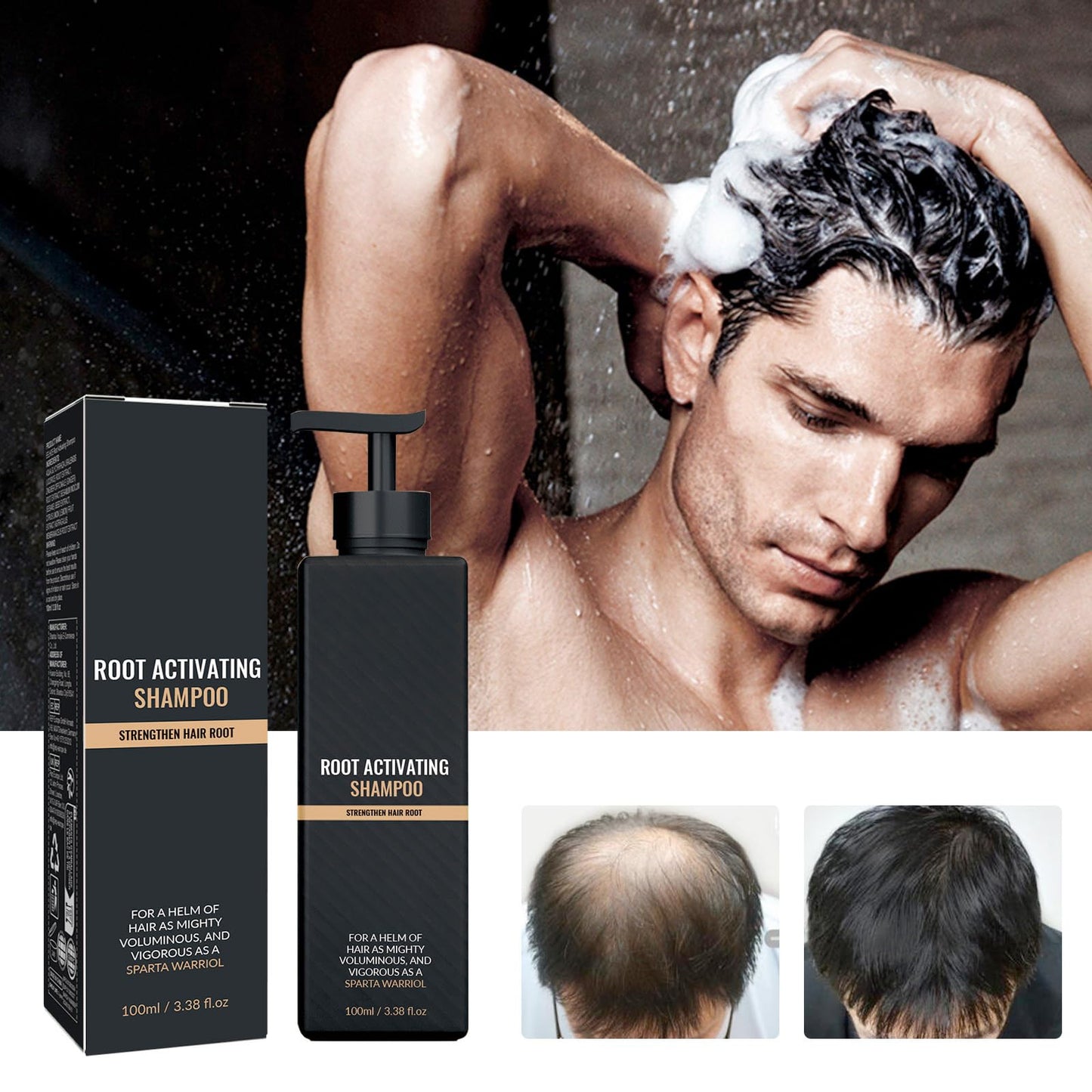 2pcs Root Activator Shampoo,Mane Root Activator Shampoo for Man,Unisex Hair Loss Shampoo,Hair Thickening Shampoo that Repairs,Smooths & Strengthens Hair,Hair Restoration Hair Care Solution