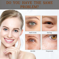Oumun 8ML Rollerball Castor Oil,Eye Cream,Castor Oil and Frankincense Eye Roller,Under Eye Cream,Castor Oil Hydrating Eye Cream,Eye Brightening Cream,Anti Aging Eye Cream,Firming Eye Cream,Eye Gel