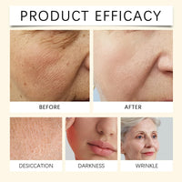 Deep Vita C Capsule Cream,Skin Tightening Cream for Face,Deep Vitamin C Golden Capsule Face Moisturizer,Vitamin C Serum,Vita C Golden Caps/ules FA/ce Mois/turizer,FA/ce Moistu/rizer for Women
