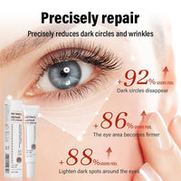 YUYUE-YY Retinol Eye Cream, Retinol Serum Eye Cream for Dark Circles and Puffy Eyes, Eye Cream with Retinol & AHA 30% & BHA 2% & Hyaluronic Acid for Fine Lines & Wrinkles Saggy Skin Puffy Eyes