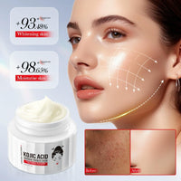 AurolaGlow Kojic Acid Cream – Brightening & Anti-Aging Dark Spot Remover – Hydrating Face Moisturizer for Dry Skin – Anti-Wrinkle Cream for Women – 50g