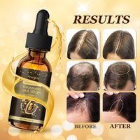 Ledeak Hair Growth Serum, 30ml Wild Growth Hair Oil, Veganic Natural Hair Growth Oil, Hair Loss Treatment for Women, Prevents Hair Loss, Hair Regrowth, Organic Hair Growth Products for Women and Men