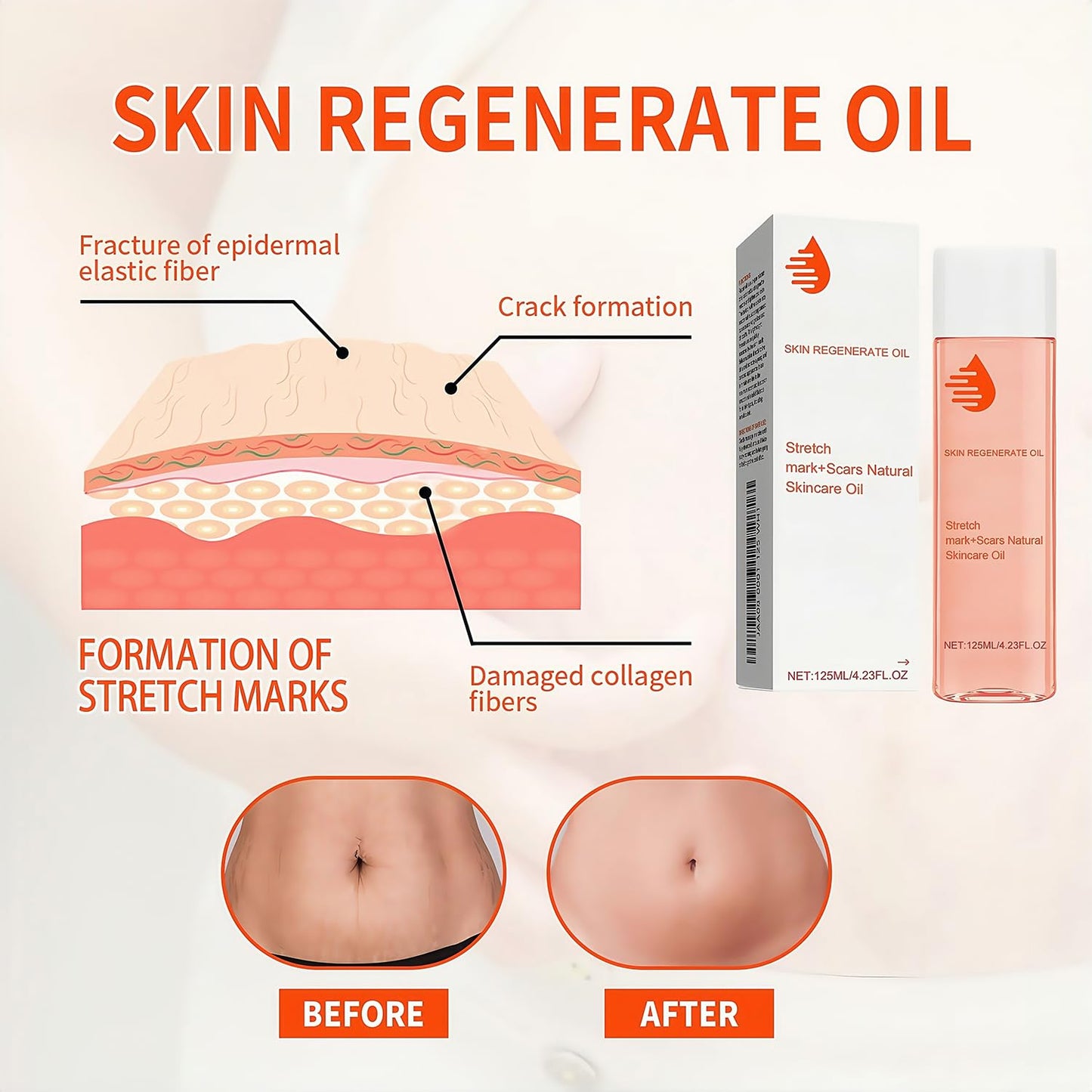 125ml Stretch Mark Oil & Scar Treatment, Skin Regeneration Oil for Stretch Marks Removal, Firming & Lifting, Collagen Boost - Body Oil for Women
