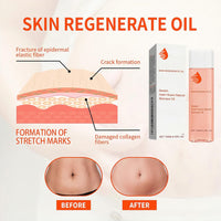 125ml Stretch Mark Oil & Scar Treatment, Skin Regeneration Oil for Stretch Marks Removal, Firming & Lifting, Collagen Boost - Body Oil for Women