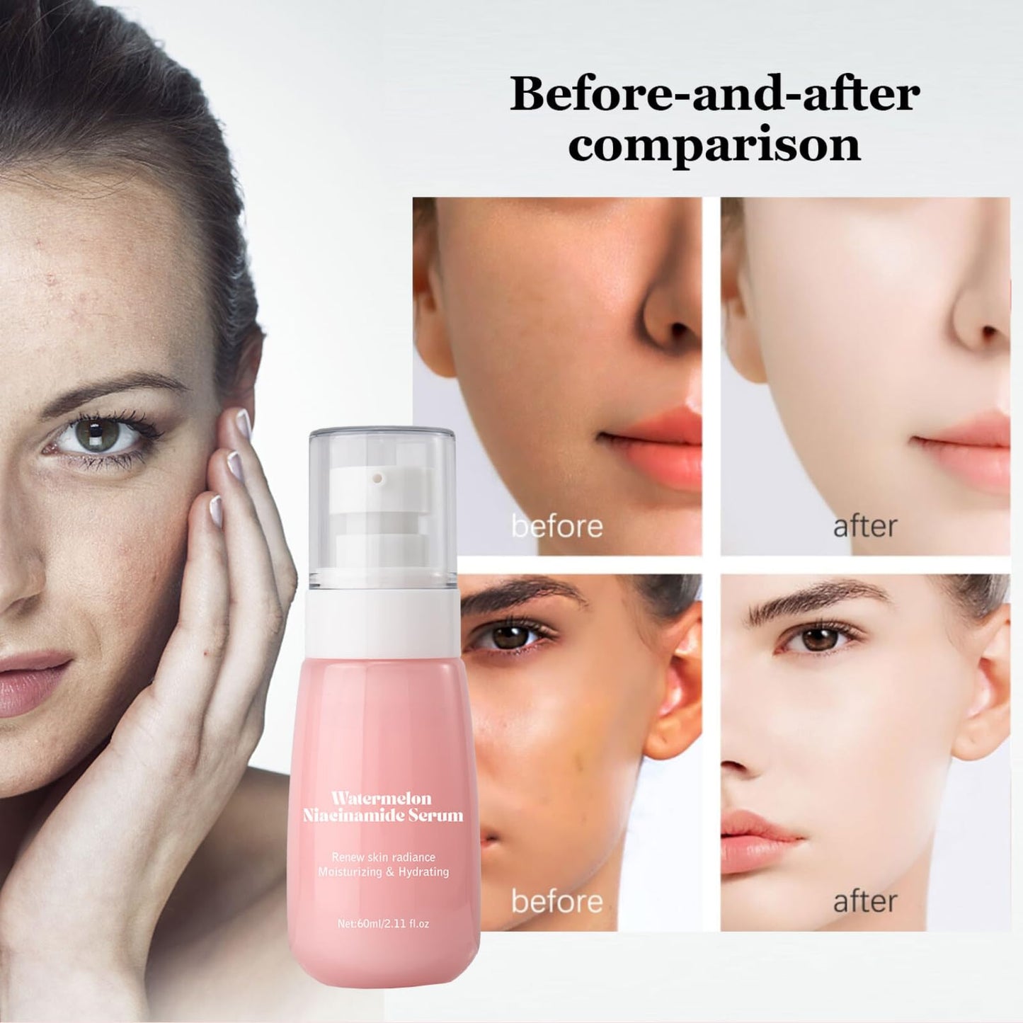 Watermelon Niacinamide Serum for Hydration, Hydrating Serum with Watermelon Extract for Radiant Glow, Niacinamide Serum for Glowing Skin, Moisturising Face Serum with Watermelon to Repair and Brighten