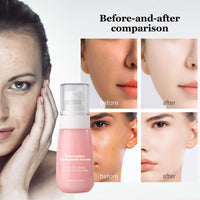 Watermelon Niacinamide Serum for Hydration, Hydrating Serum with Watermelon Extract for Radiant Glow, Niacinamide Serum for Glowing Skin, Moisturising Face Serum with Watermelon to Repair and Brighten