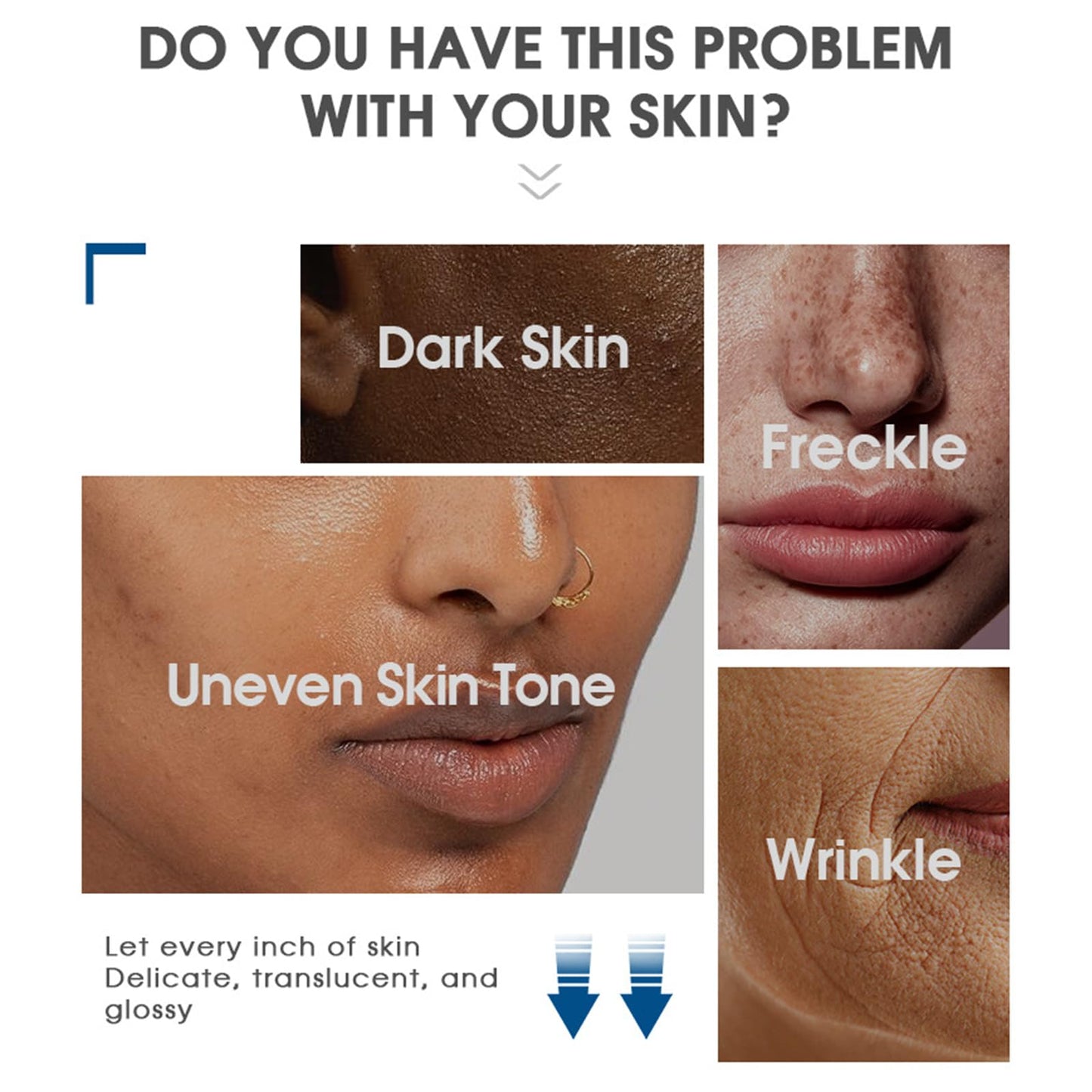 Pack of 2 Whitening Freckle Cream, Anti-Hyperpigmentation Skin Brightening Cream, Anti-Freckle Niacinamide Cream, Face Cream Against Dark Spots, Pigment Spots, Remover Face