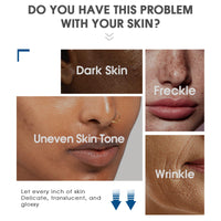 Pack of 2 Whitening Freckle Cream, Anti-Hyperpigmentation Skin Brightening Cream, Anti-Freckle Niacinamide Cream, Face Cream Against Dark Spots, Pigment Spots, Remover Face