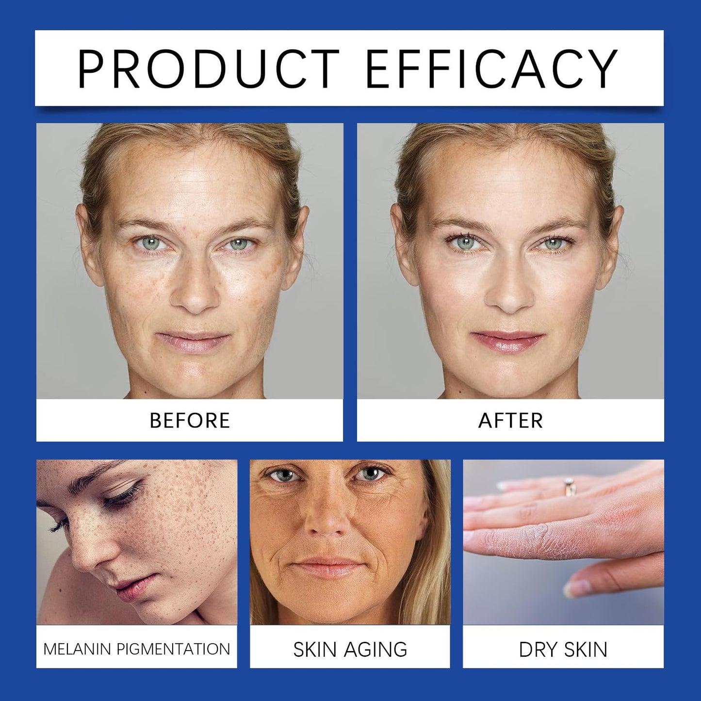 AuraBeen 4-in-1 Serum, Vitamin C, Hyaluronic Acid, Vitamin E & Niacinamide, Targets Pigmentation & Signs of Aging, 30ml