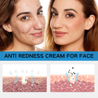 IZBEAUVO Soothing Multi-Purpose Hydrating Cream for Dry & Oil Skin - Lightweight Face & Body Moisturizer - B5 Panthenol & Centella Moisturizer - Travel Size 40ml for Redness Relief and Deep Moisturizing