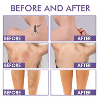 NLFOX All Over Complexion Perfector - Body Coverage Perfector Waterproof - Tattoo Cover Up Makeup Body Foundation Full Coverage - Body Coverage Perfector All in One Moisturiser Concealer,74ml