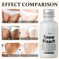 ISBEAUSOLS Skin Bleaching Cream - Body Cream for Women - Whitening Body Lotion for Intimate Area - Skin Lightening Cream For Underarm - Snow Bleach Cream for Private Part - Deep Hydration & Reduces Skin Dullness