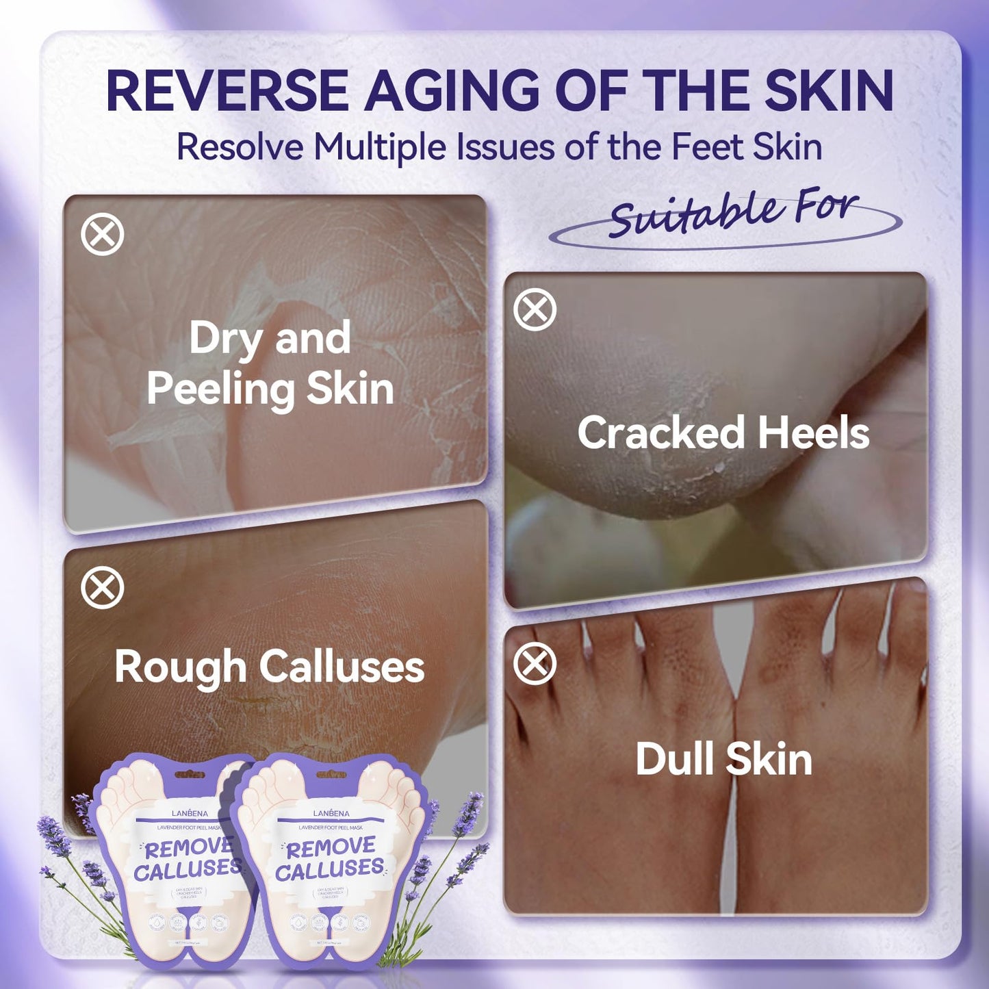 LANBENA Foot Peel Mask - 1 Pair Moisturizing and Exfoliating Foot Peeling Mask for Dry, Cracked Feet | Callus Remover | Skin - Friendly and Effective for Baby Soft Feet, Men and Women (Lavender)