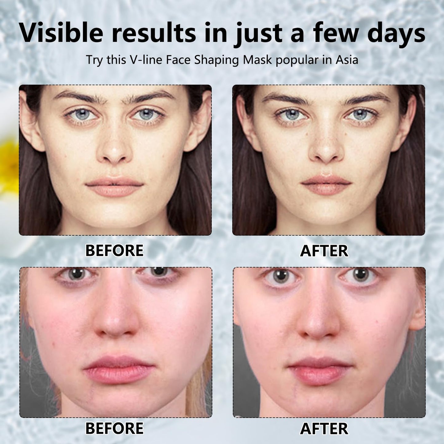 5Pcs V Line Face Lifting Chin Mask, Bloskin Double Chin Mask, Face Lift Tape for Tighten Jawline, Lift Face, Nourish Skin