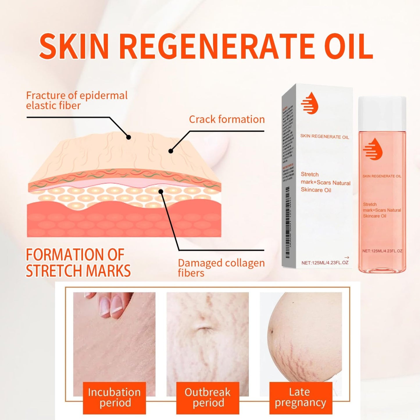 IZBEAUVO 125ml Scar Treatment Oil, Natural Stretch Mark & Scar Skincare oil, Stretch Marks Removal Body Oil for Women, Boost Collagen for Firming and Lifting Improve the Appearance of scars & Skin Tone