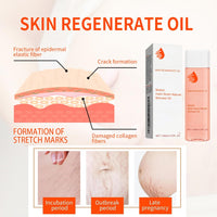 IZBEAUVO 125ml Scar Treatment Oil, Natural Stretch Mark & Scar Skincare oil, Stretch Marks Removal Body Oil for Women, Boost Collagen for Firming and Lifting Improve the Appearance of scars & Skin Tone