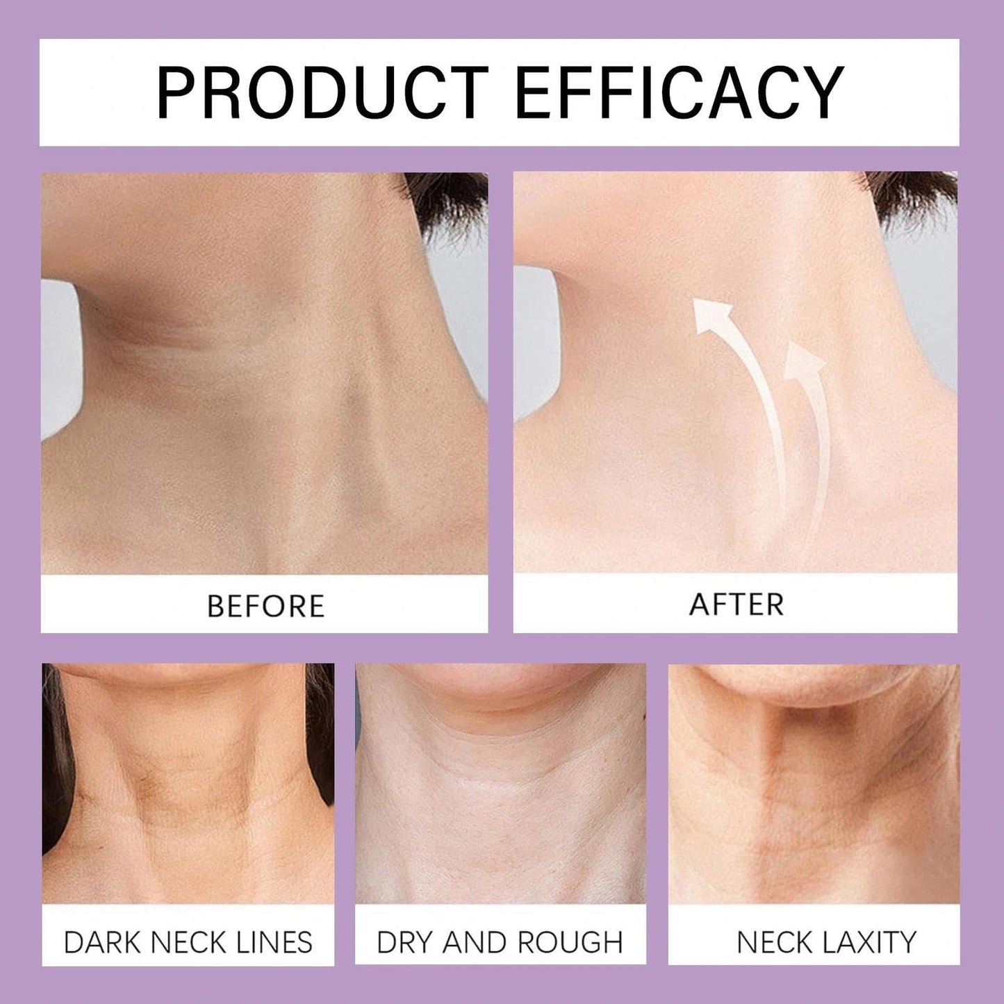 Face & Neck Cream with Collagen - A Moisturizer Infused with Collagen, Aiming to Support Skin's Natural Firmness and Hydration, Suitable for the Face and Neck Area