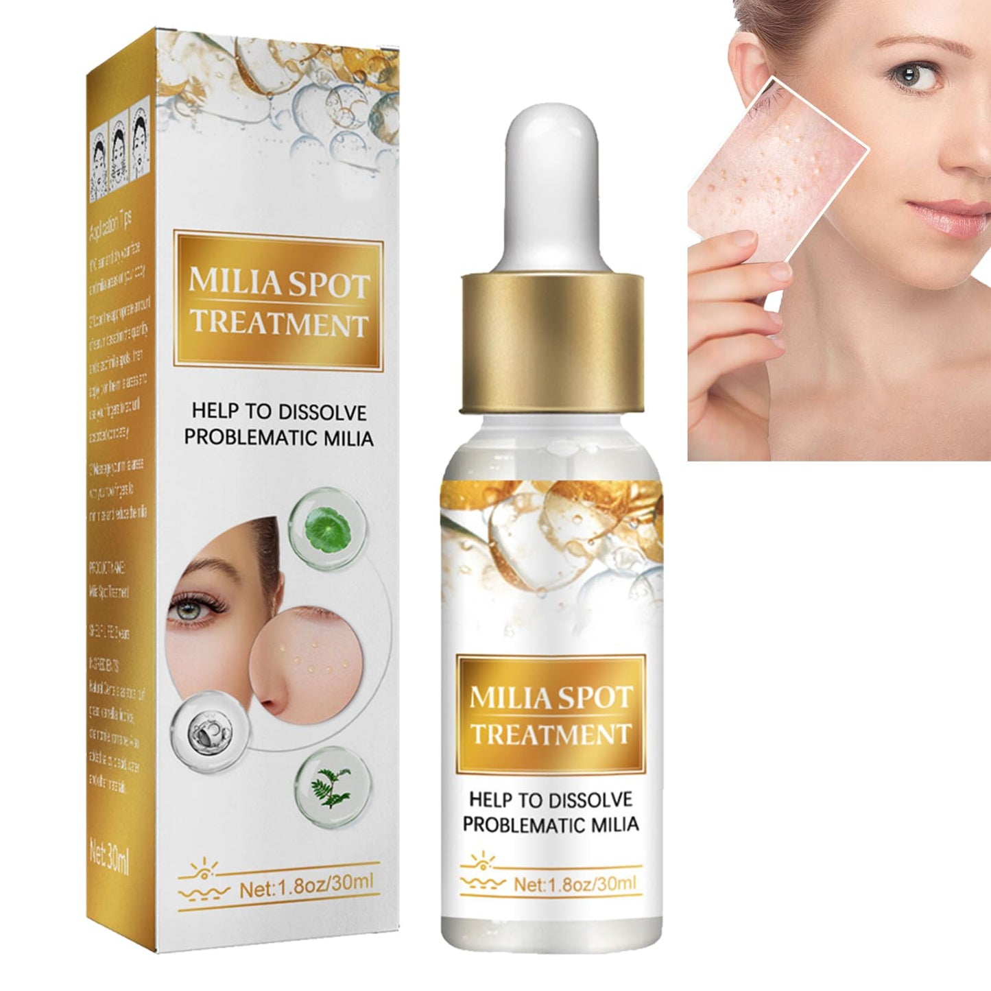 GNAUMORE Milia Spot Serum for Face,Milia Treatment under Eye,Eye Serum for Dark Circles and Puffy Eyes,Fat Granule Clearing Skin Serums,Even and Radiant Skin Generic,30ml