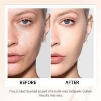 NLFOX 4 in 1 Foundation Liquid - Sunscreen Serum SPF50 Concealer and Moisturizer - Color Changing Foundation Light Spectrum with Brush - UVA/UVB Protection, Hydrating & LongLasting