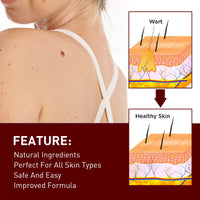 Wart Remover Pen,Mole and Wart Removal Pen,Dark Spots Treatments Mole Wa/rt Remover for Face,Liquid Pe/n Stops Regrowth Skin Care,Easy Removal P/en,Wa/rt Remov/ers for Sk/in Type,Verruca Treatments