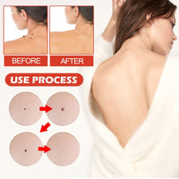 OuXing 288PCS T-ag'gone Patch,Spot Stickers,Nano Patch for Face and Skin,Face Care P/atch,Acne Pimple Patches,Skin T-ag Remover Patches,M-ole Remover,Skin Ta-g P/atches,Skin Ta-g R/emover,W-art Treatment